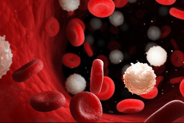 3 Tipe Kanker Darah Yang Melanda Badan Kita